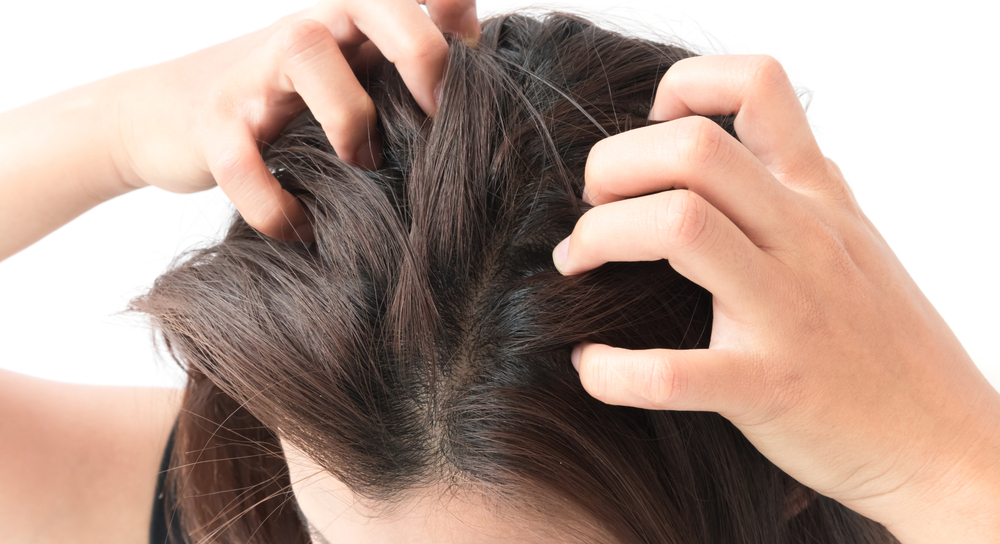 Closeup woman hand itchy scalp, Hair care concept; Shutterstock ID 598778129; other: ; purchase_order: 123; client: ; job: 